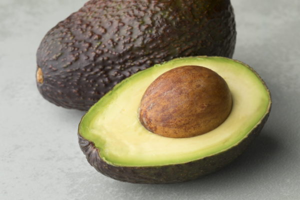 Avocat